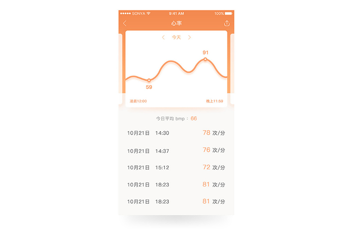 智能手环APP开发
